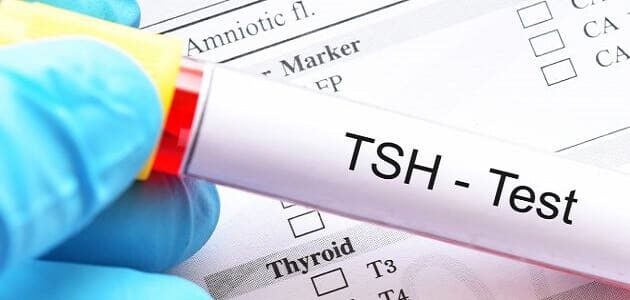 أعراض نقص هرمون T3