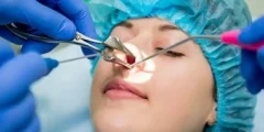 علاج تضخم القرنيات الأنفية 