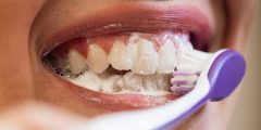 علاج تفتت الأسنان: الأسباب وطرق الوقاية
