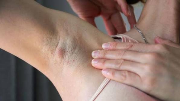 أعراض التهاب الغدد اللمفاوية تحت الإبط