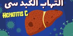 الكبد الوبائي C