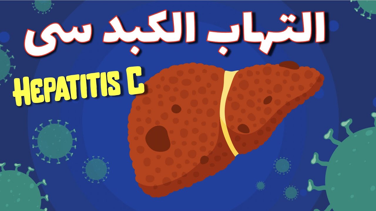 الكبد الوبائي C