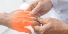 التهاب الأعصاب الطرفية