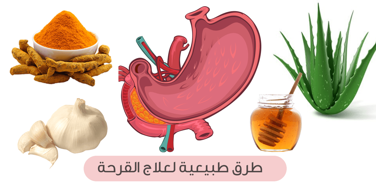 طرق لعلاج قرحة المعدة في المنزل