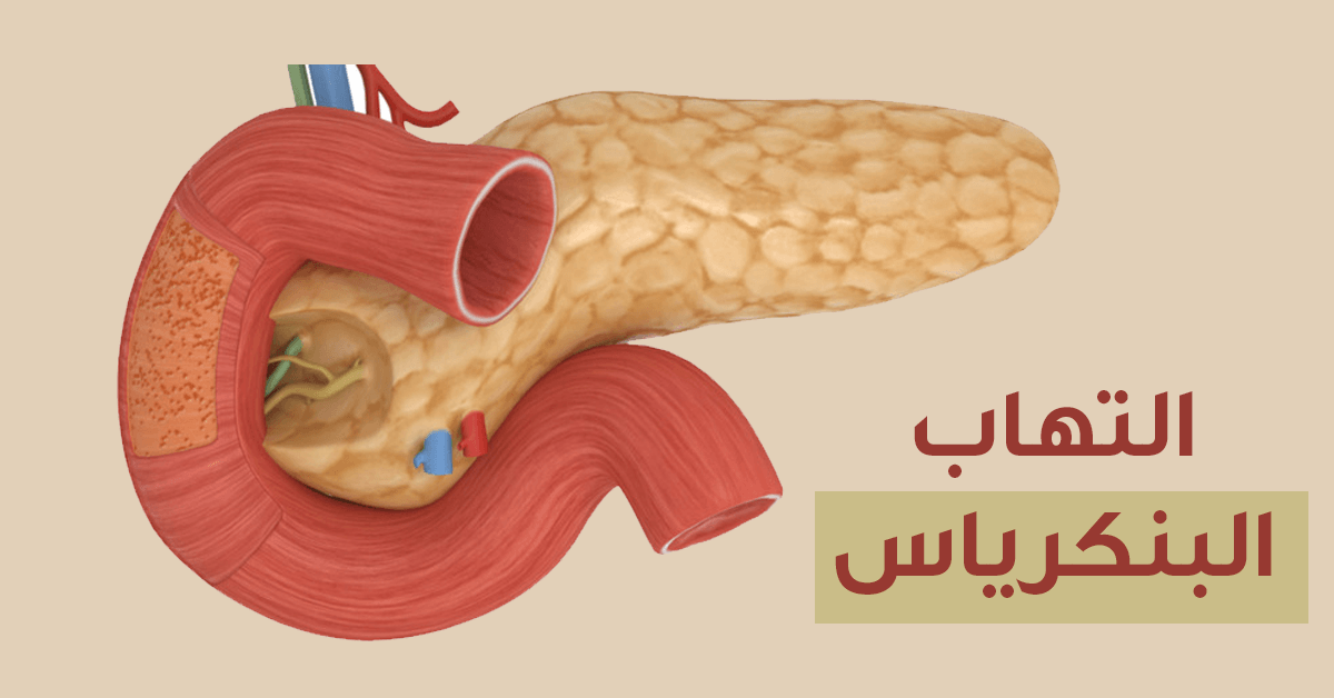 أعراض التهاب البنكرياس