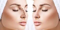 مدة التعافي من عملية انحراف الوتيرة