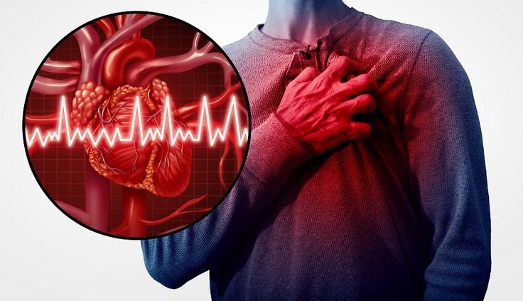 أعراض التهاب عضلة القلب
