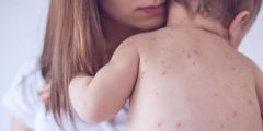 تسمم الدم للأطفال: كل ماتود معرفته