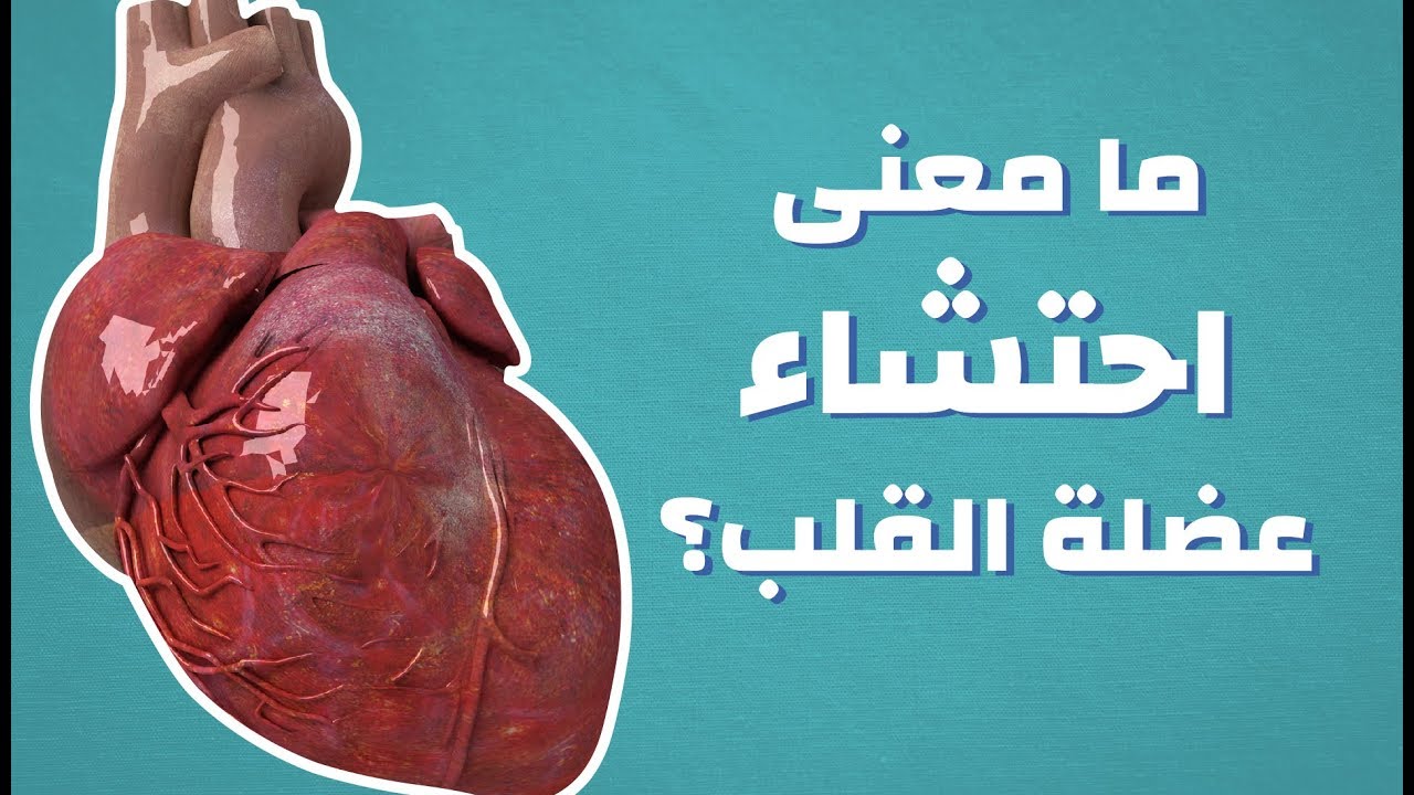 احتشاء عضلة القلب