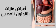 علاج احتباس الغازات بالقولون