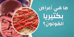 أعراض جرثومة القولون