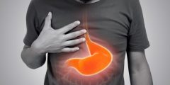 علاج التهاب جدار المعدة