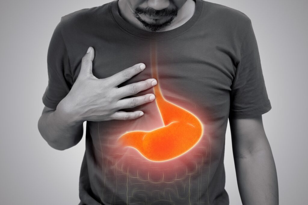 علاج التهاب جدار المعدة
