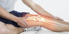 أعراض الإصابة بسرطان العظام