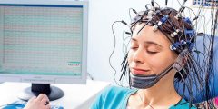 تخطيط الدماغ: كل ماتود معرفته