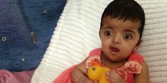 متلازمة أبرت: دليل طبي شامل
