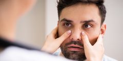 علاج التهاب الجيوب الأنفية بالأعشاب