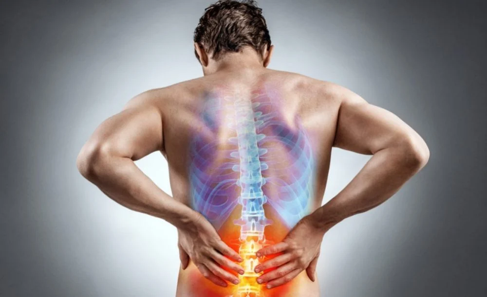 علاج عرق النسا في الطب البديل