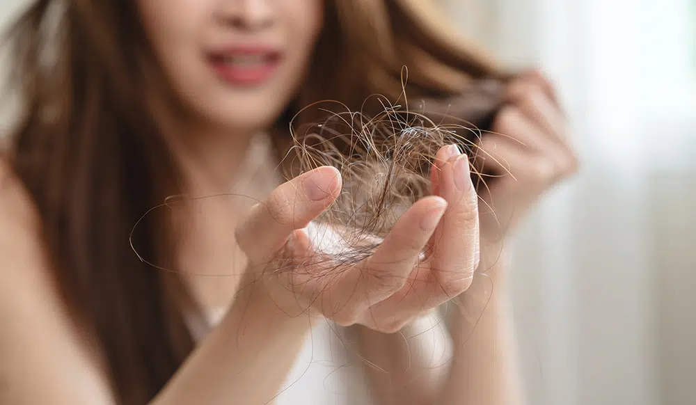 علاج تساقط الشعر بالثوم