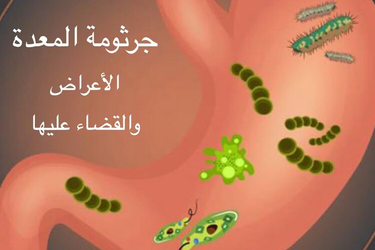 علاج جرثومة المعدة بالأعشاب​