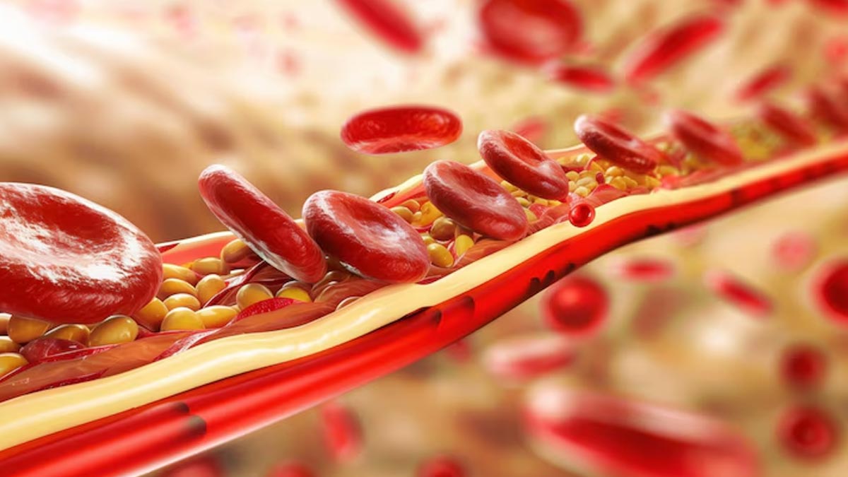 الدهون الثلاثية